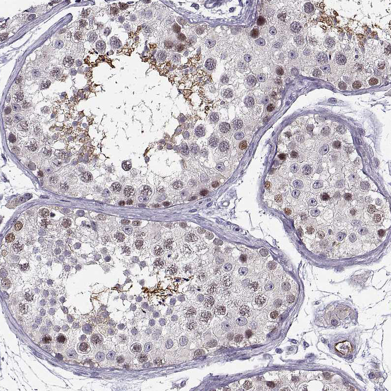 Immunohistochemical staining of human testis shows moderate nuclear and cytoplasmic positivity in cells in seminiferous ducts.