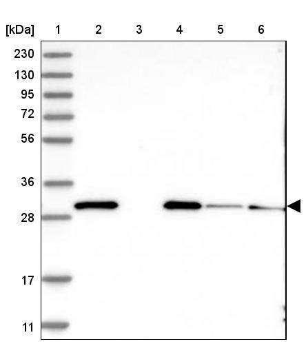 Lane 1: Marker [kDa] 230, 130, 95, 72, 56, 36, 28, 17, 11<br/>Lane 2: Human cell line RT-4<br/>Lane 3: Human cell line U-251 MG<br/>Lane 4: Human plasma<br/>Lane 5: Human Liver tissue<br/>Lane 6: Human Tonsil tissue
