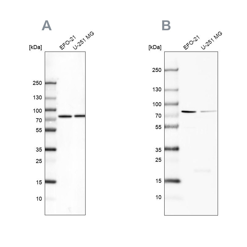 Western blot analysis using Anti-ATP6V1A antibody HPA035083 (A) shows similar pattern to independent antibody HPA035084 (B).