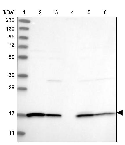 Lane 1: Marker [kDa] 230, 130, 95, 72, 56, 36, 28, 17, 11<br/>Lane 2: Human cell line RT-4<br/>Lane 3: Human cell line U-251 MG<br/>Lane 4: Human plasma<br/>Lane 5: Human Liver tissue<br/>Lane 6: Human Tonsil tissue