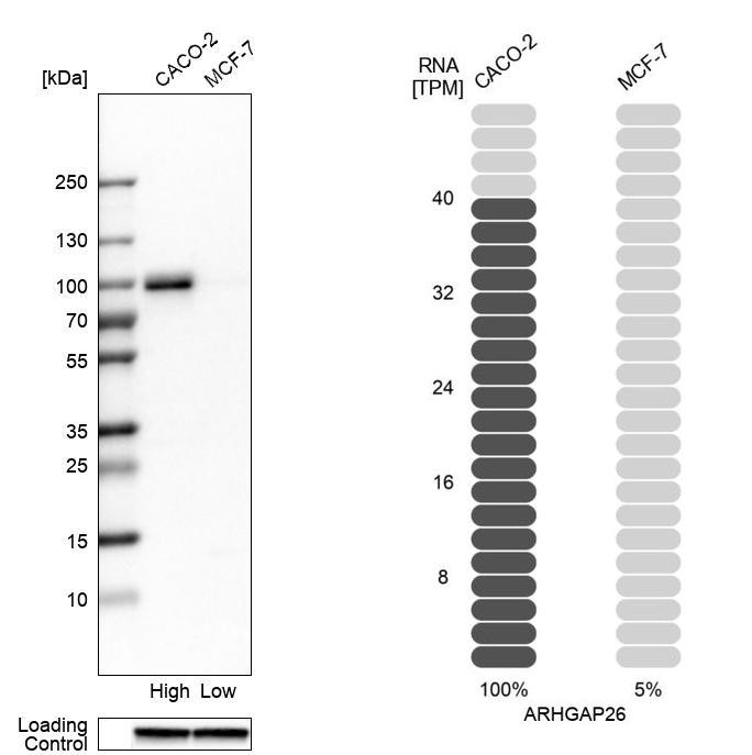 Western blot analysis in human cell lines Caco-2 and MCF-7 using Anti-ARHGAP26 antibody. Corresponding ARHGAP26 RNA-seq data are presented for the same cell lines. Loading control: Anti-GAPDH.