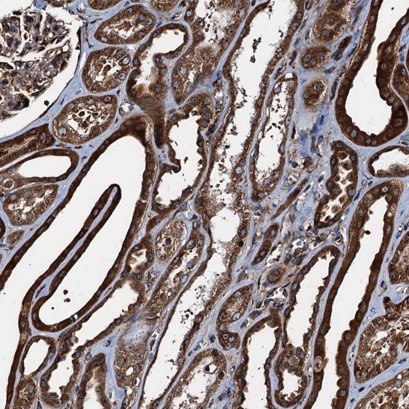 Immunohistochemical staining of human kidney shows strong cytoplasmic positivity in cells in tubules.