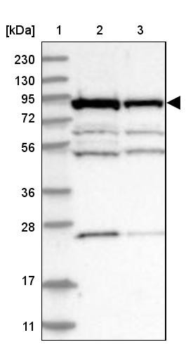 Lane 1: Marker [kDa] 230, 130, 95, 72, 56, 36, 28, 17, 11<br/>Lane 2: Human cell line RT-4<br/>Lane 3: Human cell line U-251MG sp