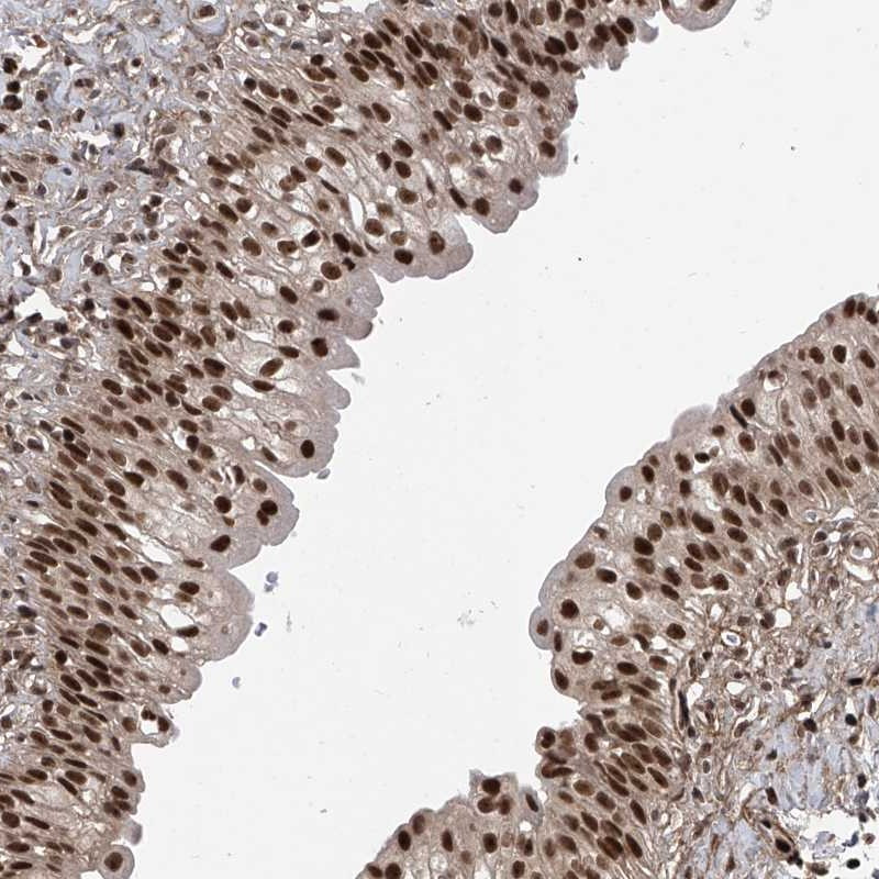 Immunohistochemical staining of human urinary bladder shows strong nuclear positivity in urothelial cells.