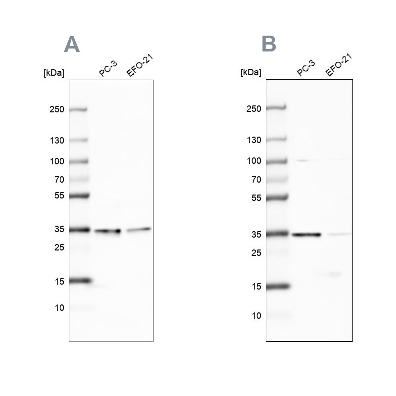Western blot analysis using Anti-DNAJC9 antibody HPA035216 (A) shows similar pattern to independent antibody HPA035215 (B).