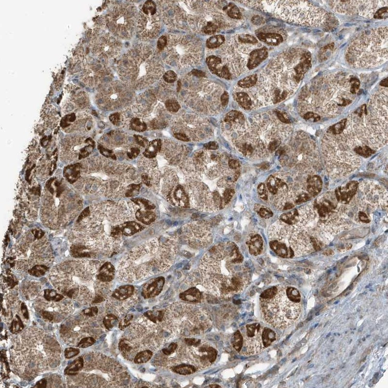 Immunohistochemical staining of human stomach shows strong cytoplasmic positivity in parietal cells.