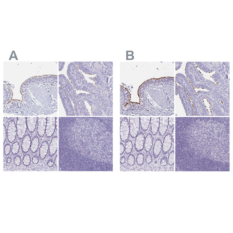 Immunohistochemical staining of human bronchus, fallopian tube, rectum and tonsil using Anti-CCDC39 antibody HPA035363 (A) shows similar protein distribution across tissues to independent antibody HPA035364 (B).