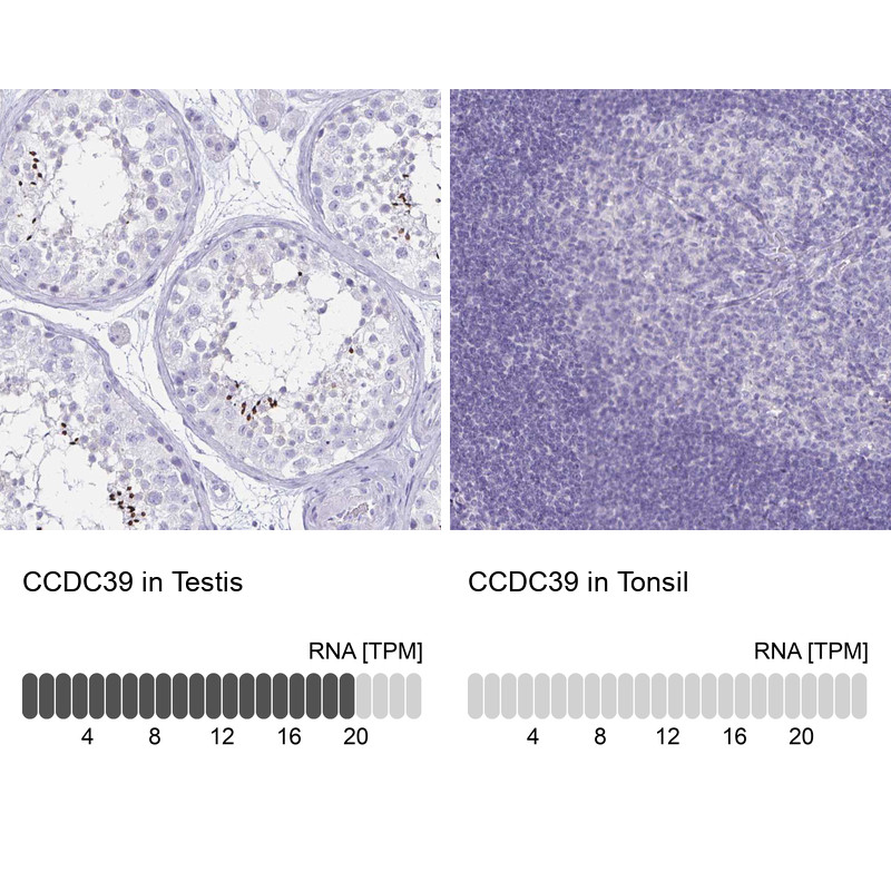 Immunohistochemistry analysis in human testis and tonsil tissues using HPA035364 antibody. Corresponding CCDC39 RNA-seq data are presented for the same tissues.