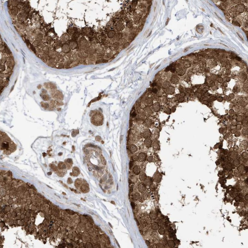 Immunohistochemical staining of human testis shows strong nuclear and cytoplasmic positivity in cells of seminiferus ducts.