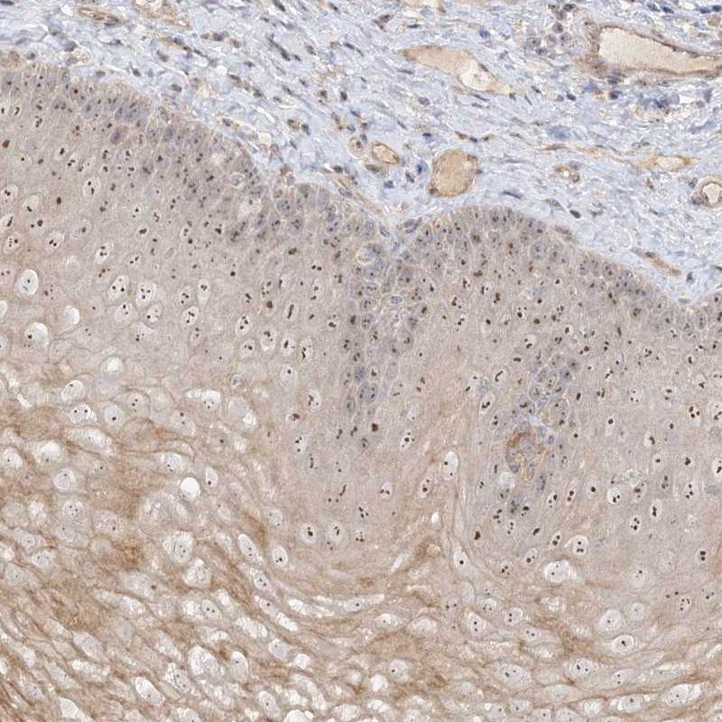 Immunohistochemical staining of human esophagus shows distinct nucleolar positivity in squamous epithelial cells.