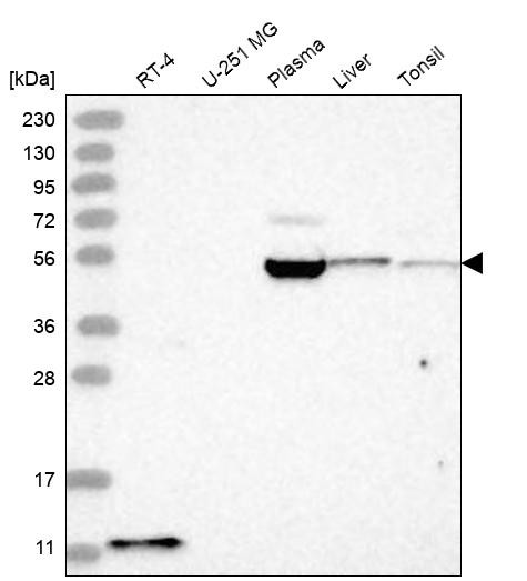 Western blot analysis in human cell line RT-4, human cell line U-251 MG, human plasma, human liver tissue and human tonsil tissue.