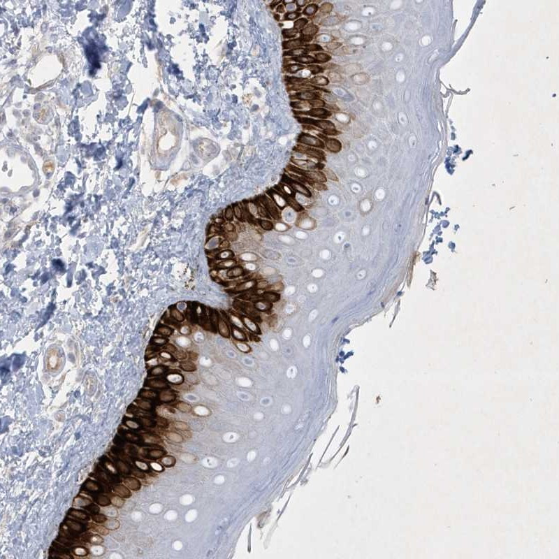 Immunohistochemical staining of human skin shows strong cytoplasmic positivity in basal layers of epidermal cells.