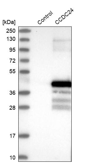 Western blot analysis in control (vector only transfected HEK293T lysate) and CCDC24 over-expression lysate (Co-expressed with a C-terminal myc-DDK tag (~3.1 kDa) in mammalian HEK293T cells, LY407505).