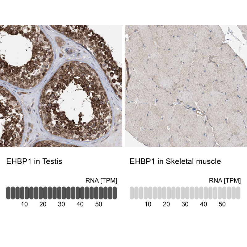 Immunohistochemistry analysis in human testis and skeletal muscle tissues using HPA035468 antibody. Corresponding EHBP1 RNA-seq data are presented for the same tissues.