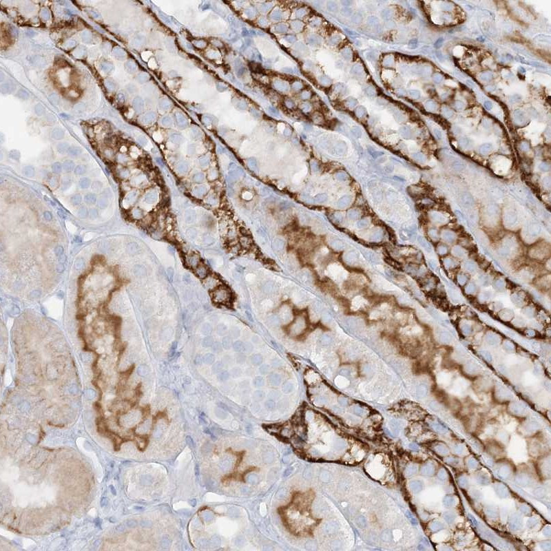 Immunohistochemical staining of human kidney shows strong cytoplasmic and membranous positivity in distal tubules.