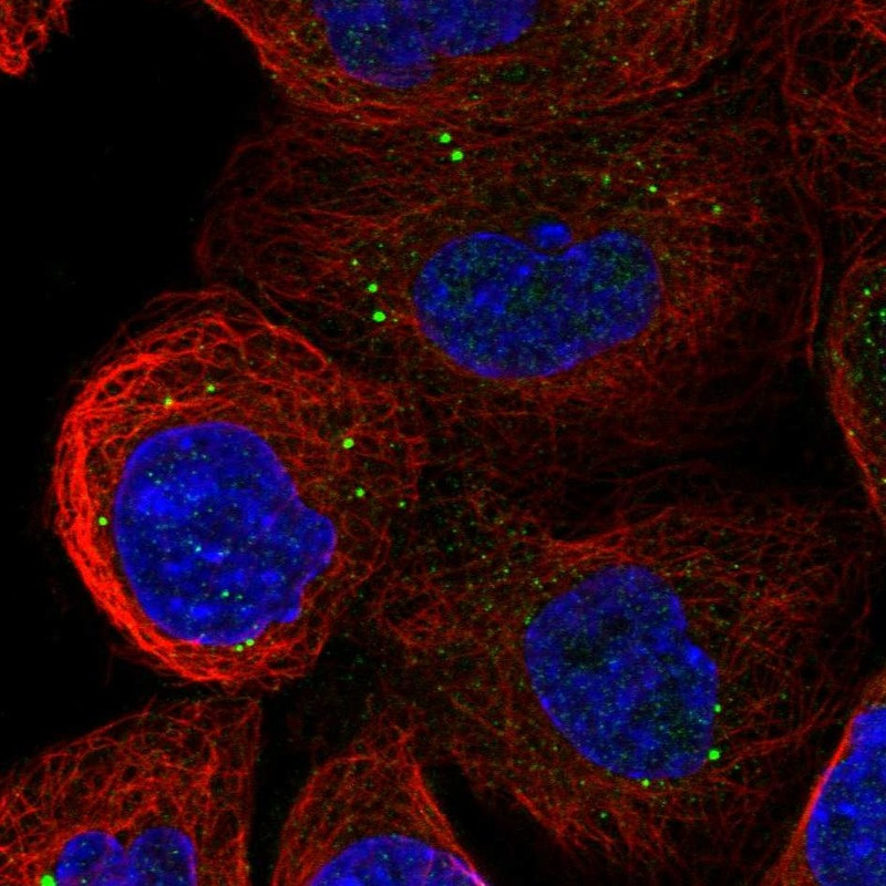Immunofluorescent staining of human cell line A-431 shows localization to vesicles.
