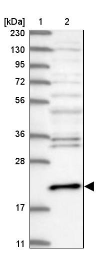 Lane 1: Marker [kDa] 230, 130, 95, 72, 56, 36, 28, 17, 11<br/>Lane 2: Human cell line RT-4