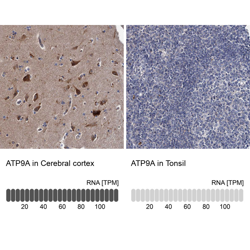 Immunohistochemistry analysis in human cerebral cortex and tonsil tissues using HPA035630 antibody. Corresponding ATP9A RNA-seq data are presented for the same tissues.
