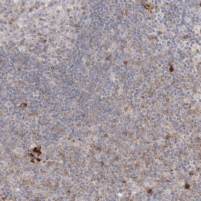 Immunohistochemical staining of human lymph node shows strong cytoplasmic positivity in a subset of non-germinal centre cells.