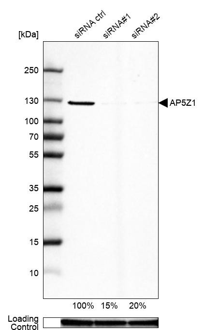 Western blot analysis in U-87MG ATCC cells transfected with control siRNA, target specific siRNA probe #1 and #2, using Anti-AP5Z1 antibody. Remaining relative intensity is presented. Loading control: Anti-GAPDH.
