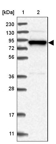 Lane 1: Marker [kDa] 230, 130, 95, 72, 56, 36, 28, 17, 11<br/>Lane 2: Human cell line RT-4