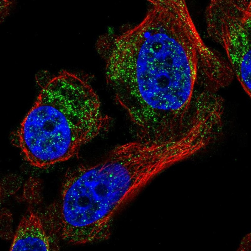 Immunofluorescent staining of human cell line PC-3 shows localization to cytosol.