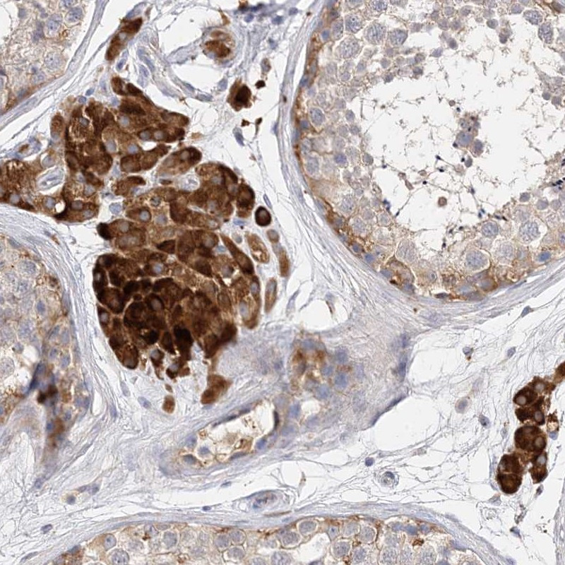 Immunohistochemical staining of human testis shows strong cytoplasmic positivity in Leydig cells.