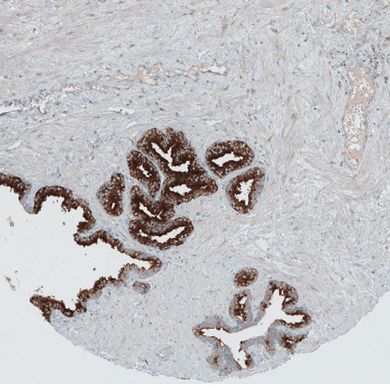 Immunohistochemical staining of human prostate shows moderate to strong cytoplasmic positivity in glandular cells.