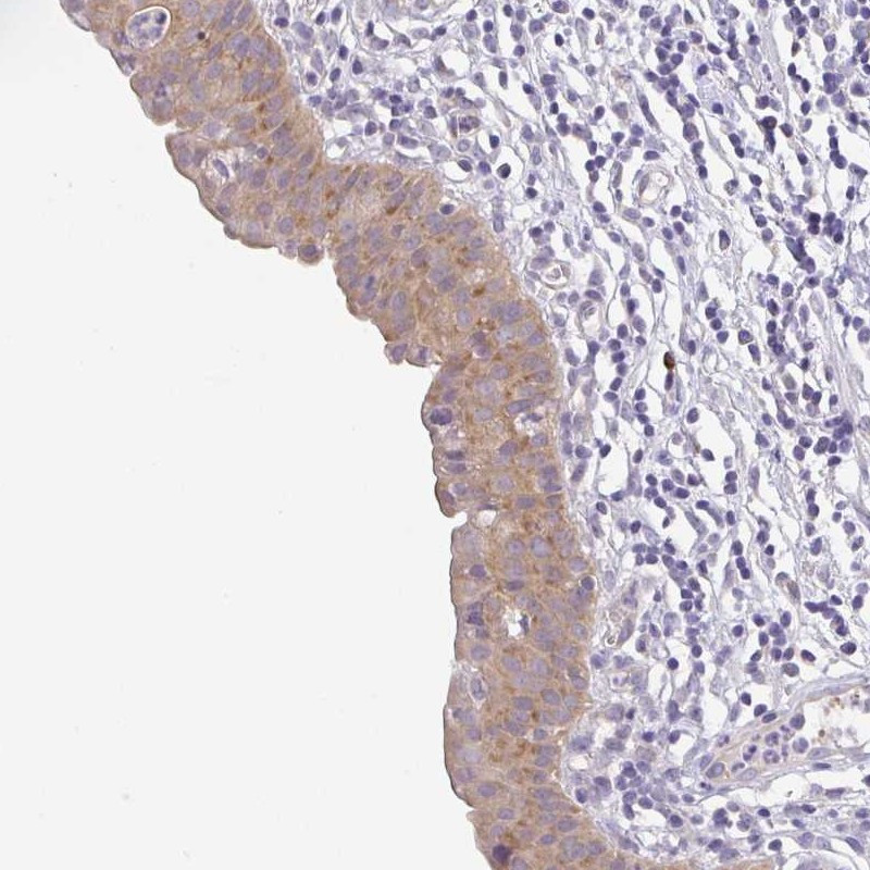 Immunohistochemical staining of human urinary bladder shows moderate cytoplasmic positivity in urothelial cells.