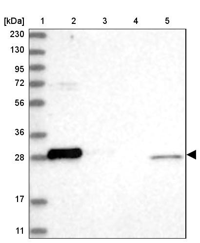 Lane 1: Marker [kDa] 230, 130, 95, 72, 56, 36, 28, 17, 11<br/>Lane 2: Human cell line RT-4<br/>Lane 3: Human cell line U-251 MG<br/>Lane 4: Human plasma<br/>Lane 5: Human Liver tissue