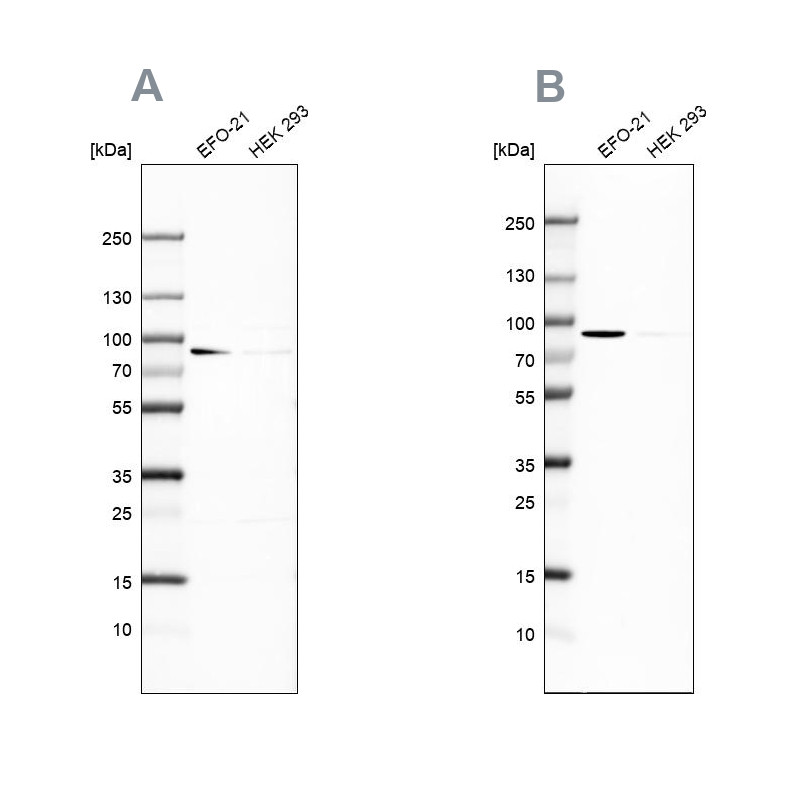 Western blot analysis using Anti-DPP3 antibody HPA035780 (A) shows similar pattern to independent antibody HPA035781 (B).