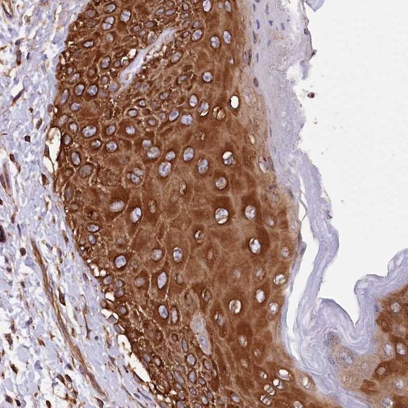 Immunohistochemical staining of human vulva/anal skin shows strong cytoplasmic positivity in squamous epithelial cells.