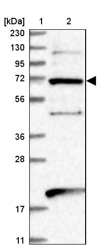 Lane 1: Marker [kDa] 230, 130, 95, 72, 56, 36, 28, 17, 11<br/>Lane 2: Human cell line RT-4