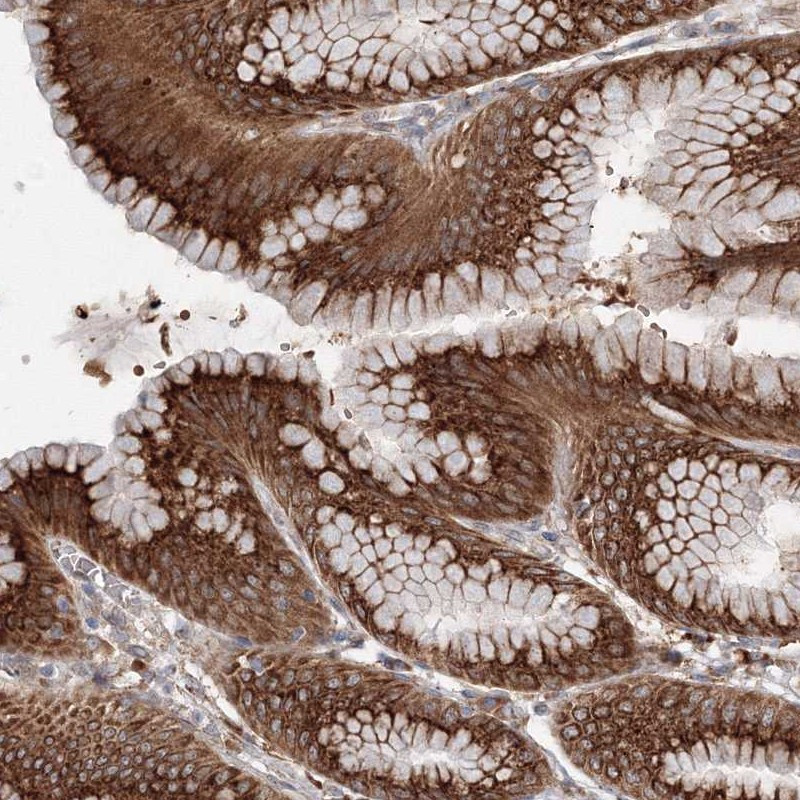 Immunohistochemical staining of human stomach, lower shows strong cytoplasmic positivity in glandular cells.