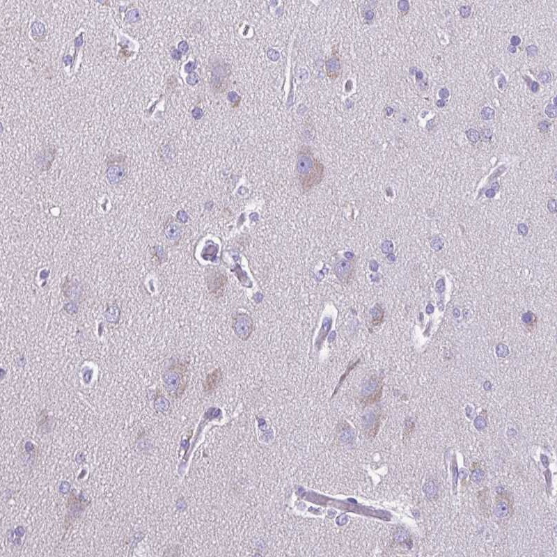 Immunohistochemical staining of human cerebral cortex shows moderate cytoplasmic positivity in neuronal cells.