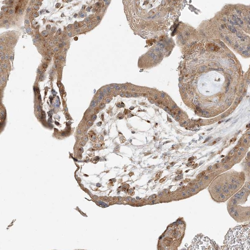 Immunohistochemical staining of human placenta shows cytoplasmic positivity in trophoblasts.