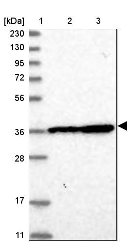 Lane 1: Marker [kDa] 230, 130, 95, 72, 56, 36, 28, 17, 11<br/>Lane 2: Human cell line RT-4<br/>Lane 3: Human cell line U-251MG sp