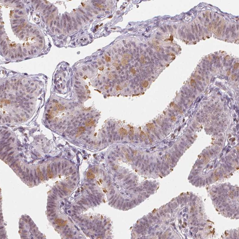 Immunohistochemical staining of human fallopian tube shows moderate positivity in cilia.