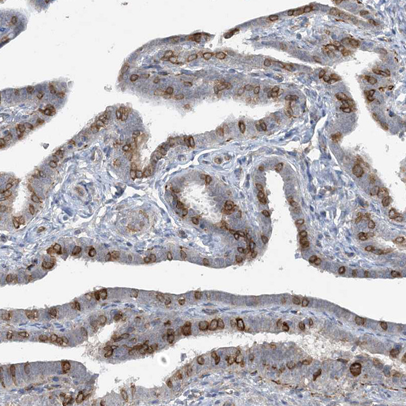 Immunohistochemical staining of human fallopian tube shows moderate membranous positivity in glandular cells.