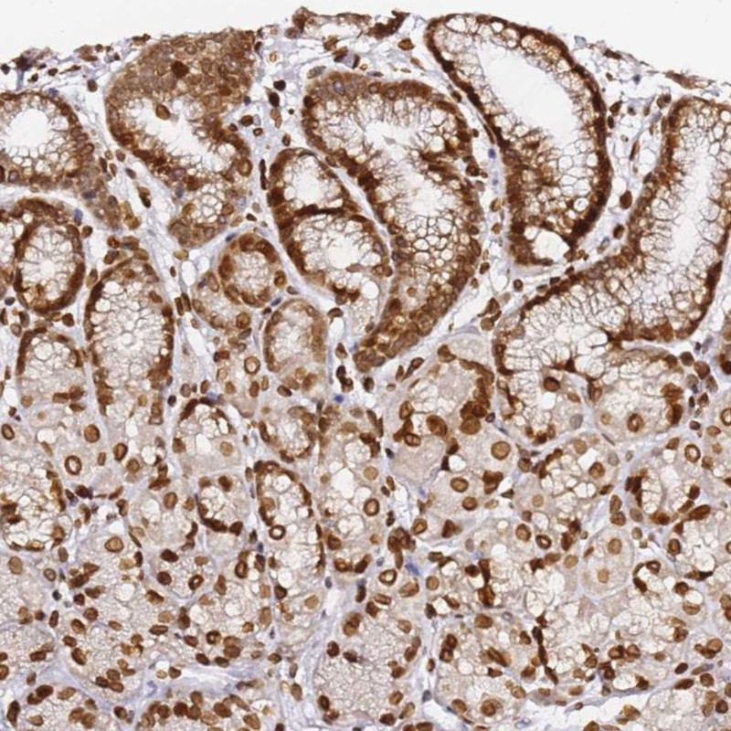 Immunohistochemical staining of human stomach, lower shows strong nuclear membranous and cytoplasmic positivity in glandular cells.