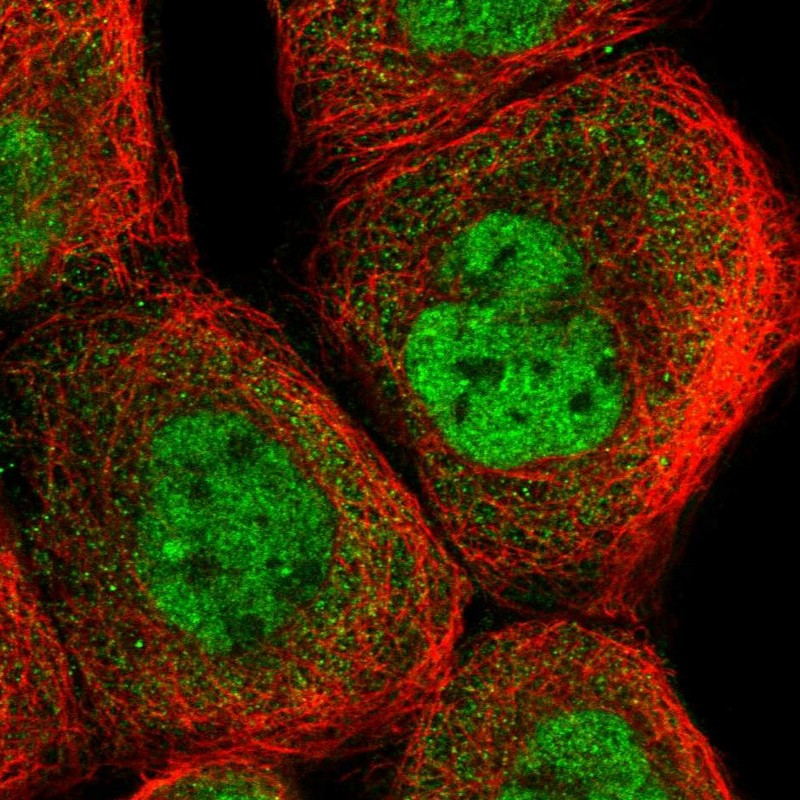 Immunofluorescent staining of human cell line A-431 shows localization to nucleoplasm & cytosol.