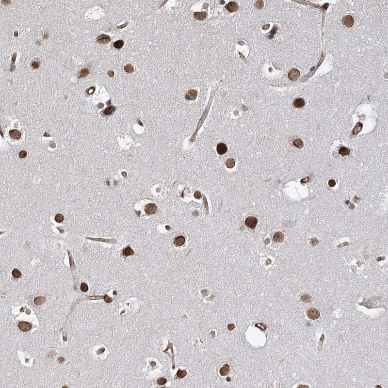 Immunohistochemical staining of human cerebral cortex shows strong nuclear positivity in neuronal cells.