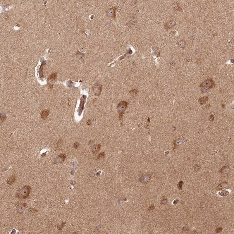 Immunohistochemical staining of human cerebral cortex shows strong cytoplasmic and nucleolar positivity in neuronal cells.
