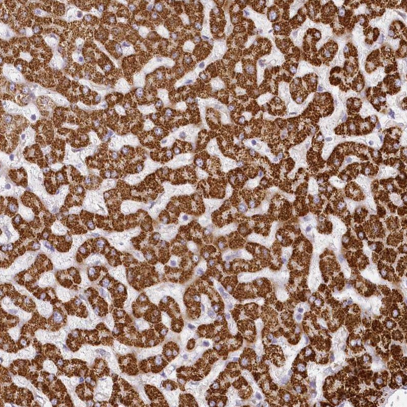 Immunohistochemical staining of human liver shows strong cytoplasmic positivity in hepatocytes.