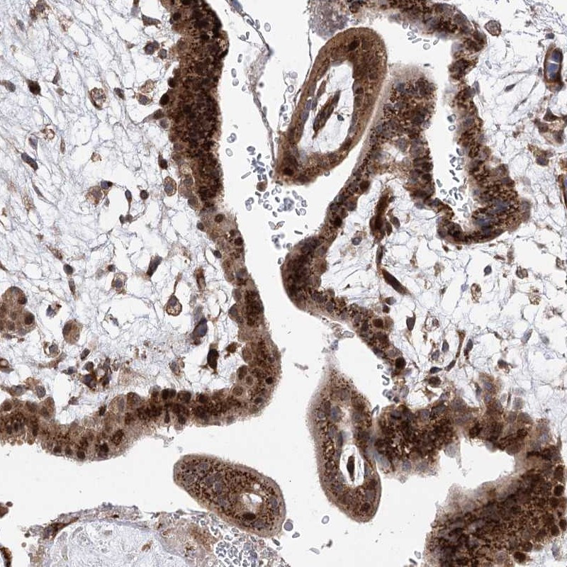 Immunohistochemical staining of human placenta shows cytoplasmic and nuclear positivity in trophoblastic cells.