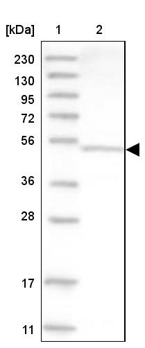 Lane 1: Marker [kDa] 230, 130, 95, 72, 56, 36, 28, 17, 11<br/>Lane 2: Human cell line RT-4