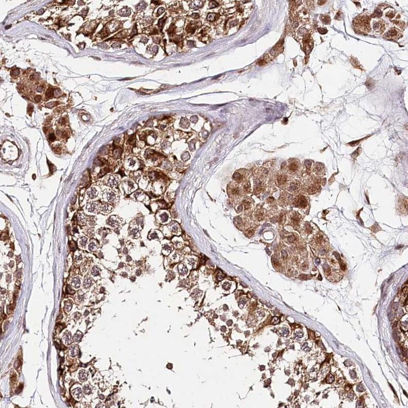 Immunohistochemical staining of human testis shows strong cytoplasmic and nuclear positivity in cells in seminiferus ducts and Leydig cells.