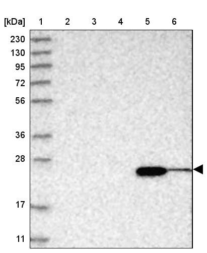 Lane 1: Marker [kDa] 230, 130, 95, 72, 56, 36, 28, 17, 11<br/>Lane 2: Human cell line RT-4<br/>Lane 3: Human cell line U-251MG sp<br/>Lane 4: Human plasma (IgG/HSA depleted)<br/>Lane 5: Human liver tissue<br/>Lane 6: Human tonsil tissue