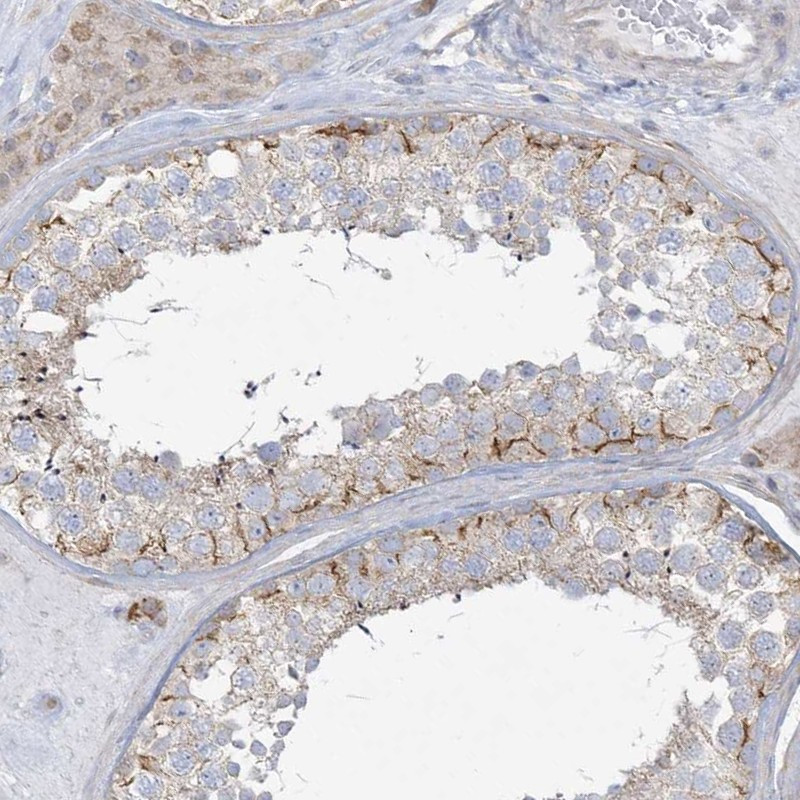 Immunohistochemical staining of human testis shows strong membranous positivity in cells in seminiferous ducts.