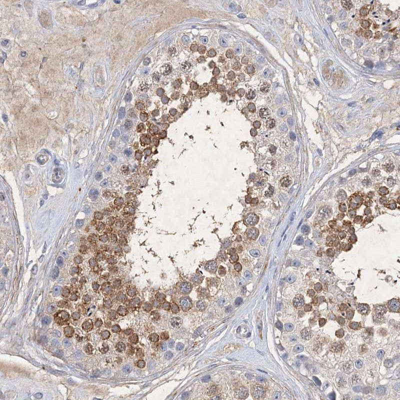 Immunohistochemical staining of human testis shows moderate cytoplasmic positivity in cells in seminiferus ducts.